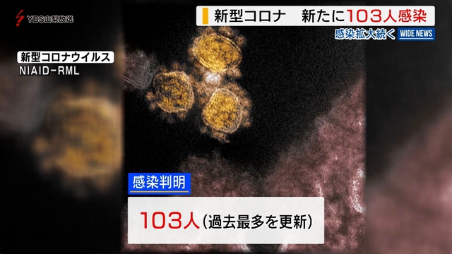 新型コロナ　過去最多１０３人の感染を発表